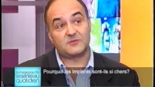 Pourquoi les implants dentaires sontils si chers [upl. by Bessy153]