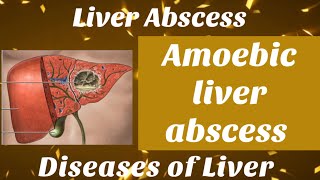 Amoebic liver abscess  in Hindi with notes  liver abscess surgery bamsfinalyear shalyatantra [upl. by Kred247]