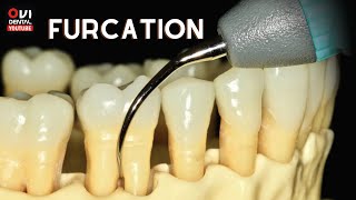 FURCATION The anatomic area of a multirooted tooth where the roots diverge [upl. by Secnarfyram]