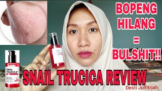 KENAPA BERHENTI PAKAI SERUM SNAIL TRUECICA  REVIEW JUJUR [upl. by Alyks]