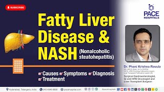 Fatty Liver Disease amp NASH Nonalcoholic Steatohepatitis  Causes Symptoms Diagnosis amp Treatment [upl. by Einnoj]