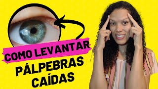 21 Como levantar pálpebras caídas  Exercícios Visuais para ptose palpebral [upl. by Ubald997]