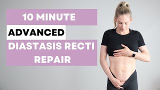 Diastasis Recti Repair Workout  ADVANCED  heal  strengthen your core postpartum [upl. by Yacov]