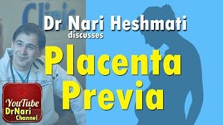 Placenta Previa amp Low lying Placenta in Pregnancy Discussed by Dr Nariman Nari Heshmati [upl. by Juanne]