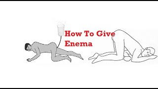 How To Give Enema  Demonastration and See Procedure [upl. by Hobard80]