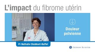 Limpact des douleurs en cas de fibrome utérin [upl. by Bendick]