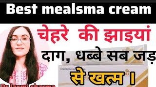 MELX melasma cream full review in hindi  झाईयों को साफ करने की बेस्ट होम्योपैथिक क्रीम [upl. by Smiga973]