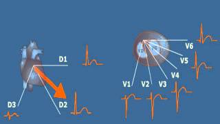 CARDIOLOGIE ECG Normal et Pathologique [upl. by Burgess627]