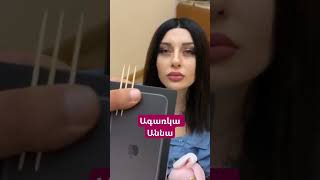 armenia yerevan erevan բոցեր vardanghukasyan hayastan armeniangirl հայեր haykakantiktok [upl. by Zetrac]