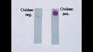 Oxidase Test [upl. by Josepha884]