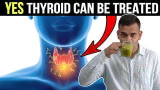 4 Easy Tips To Control Thyroid Issue  Cure Thyroid Problem IN 4 Natural Ways  Dr Vivek Joshi [upl. by Acnairb960]