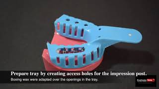 Impression Techniques for Implant Dentistry  Step by Step Open tray Impression technique [upl. by Jewelle496]