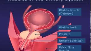 Botox Injections for Bladder Conditions [upl. by Obeng]