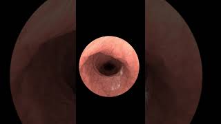 Exploring Your Insides with Gastrointestinal Endoscopy Animation 2024 [upl. by Camden]