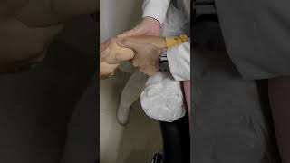 FRACTURA LUXACION DE CODO ELBOW FRACTURE DISLOCATION [upl. by Choo]