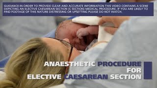 Anaesthetic procedure for elective caesarean section C section [upl. by Nameerf525]