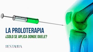 La proloterapia ¿Solo se aplica donde duele [upl. by Raclima]