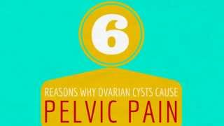 6 Reasons Why Ovarian Cysts Cause Pelvic Pain  Ovarian Cyst Symptoms [upl. by Isdnyl258]