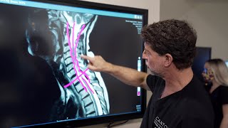 Symptoms of Cervical Stenosis  Jeffrey Cantor MD [upl. by Rma]