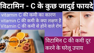 विटामिन C के जादुई फायदे vitamin C ke jaadui fayde My Dentist [upl. by Benzel]