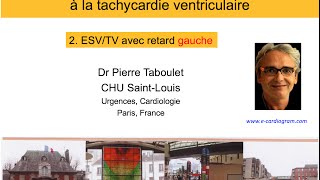 10b De lESV à la tachycardie ventriculaire Retard gauche P Taboulet [upl. by Ahsinak]