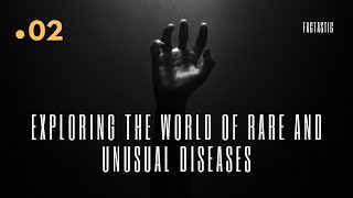 Unveiling the Unseen10 Rare And Unusual Diseases [upl. by Austen518]