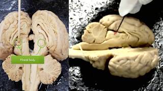 Sheep Brain Dissection Guide [upl. by Medwin]