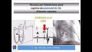 4° Modulo  A Diagnóstico y manejo de bradiarritmias en guardia [upl. by Danny468]