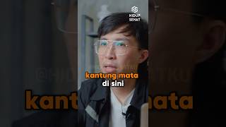 Menghilangkan kantung mata 😩  dr Tirta tipssehat tips doktertirta drtirta tipshidupsehat [upl. by Nica]