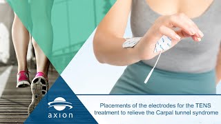 Carpal Tunnel Syndrome Pad Placement For Electrical Stimulation TENS  axion [upl. by Reivaj]