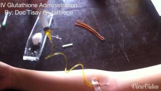 How to inject Glutathione Intravenous IV [upl. by Georglana]