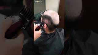 Protez Saç Merkezi SWell Hair hairreplacement protezsaç [upl. by Cadell]