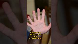 WHAT TO KNOW ABOUT PEOPLE WITH 6 FINGERS🖐️☝️ [upl. by Dicks229]