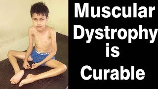 muscular dystrophy treatment  successful treatment of muscular dystrophy in tamilnadu india [upl. by Nirac959]