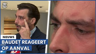 Thierry Baudet toont hoofdwond Dit was een politieke aanslag [upl. by Ddej357]