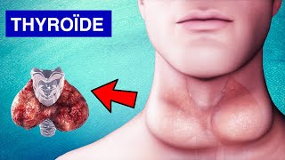 Glande Thyroïde  Pathologies Symptômes et Traitements [upl. by Keldon]