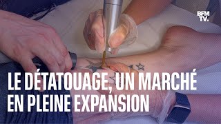 Le détatouage un marché en pleine expansion [upl. by Maegan]