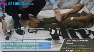 Traction Splint Set TS01  wwwalatkesehatanid [upl. by May634]