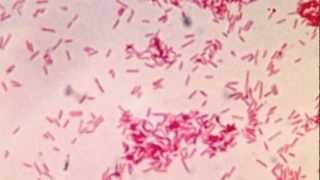 Fusobacterium and Infections [upl. by Etolas871]