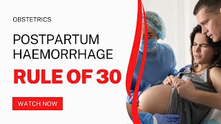 Rule of 30  Postpartum Haemorrhage  Mnemonic  Obstetric Made Easy [upl. by Linden]