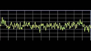 Vision Disorders  Rife Frequencies [upl. by Jacquie]