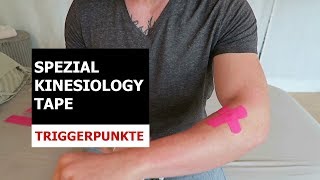 Taping Anleitung Triggerpunkte richtig tapen Kinesiologisches Taping  BODY TAPE  2021 [upl. by Jule]