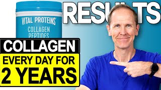 Vital Proteins Collagen Peptides  Results After 2 Years [upl. by Lianna]