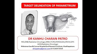 PRACTICAL DEMONSTRATION OF TARGET DELINEATION OF PARAMETRIUM [upl. by Nirac]