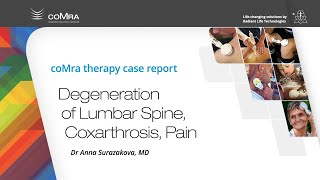 Degeneration of Lumbar Spine Coxarthrosis Pain [upl. by Agostino619]