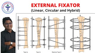 External Fixator  Lecture 07  Orthopedics [upl. by Wivina]