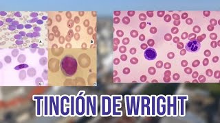 Tinción de Wright [upl. by Ioj400]