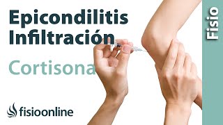 Epicondilitis o codo de tenista y las infiltraciones de cortisona o corticoides [upl. by Kennan343]