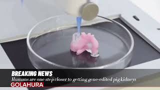 Humans are one step closer to getting geneedited pig kidneys [upl. by Wenger]