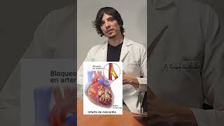 🔹¿Qué es la Pletismografía Arterial de Extremidades Aquí te lo explico 👨‍⚕️ [upl. by Autumn]